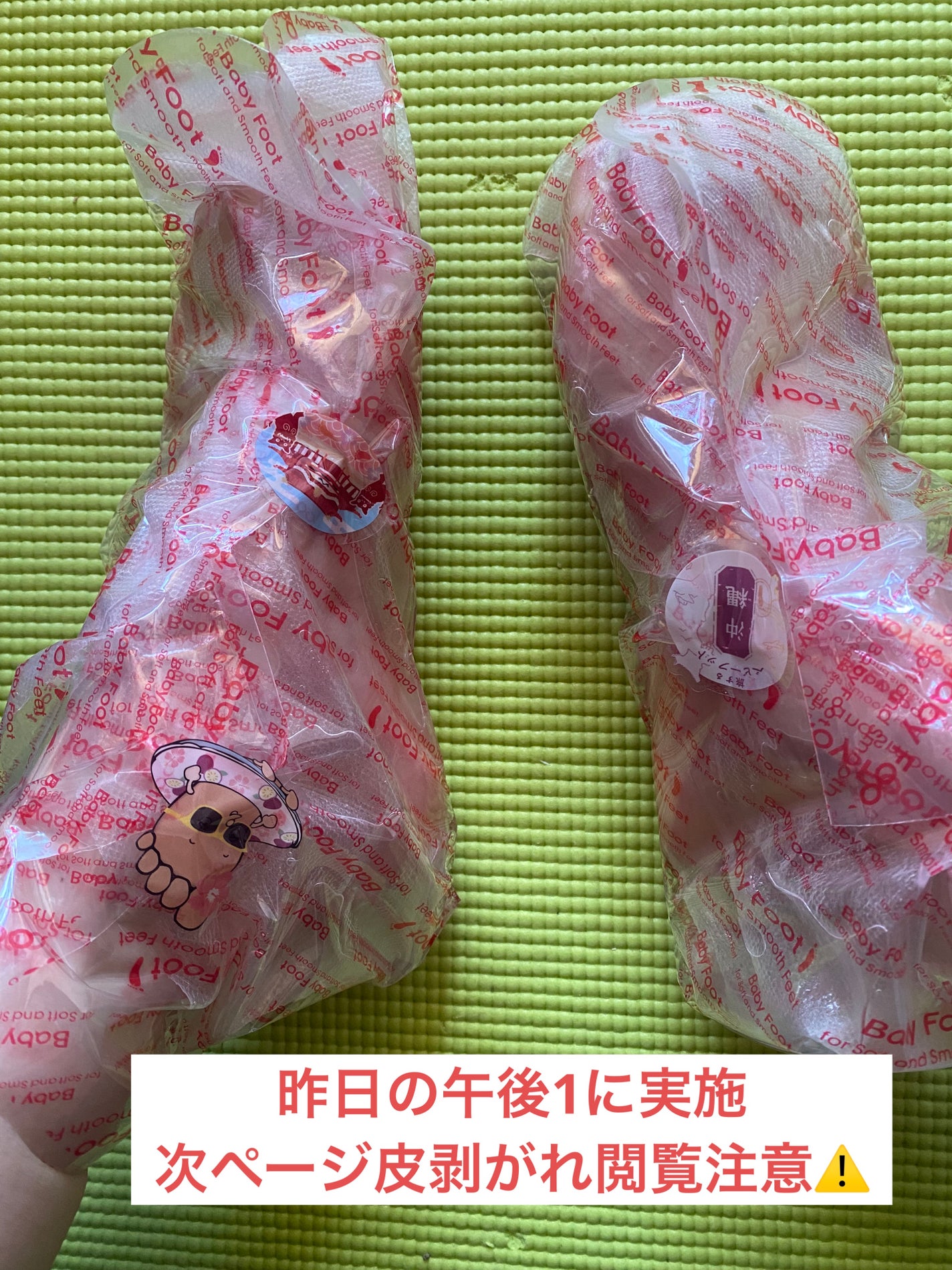 イージーパックSPT 30分タイプ/ベビーフット/レッグ・フットケアを使ったクチコミ(1枚目)