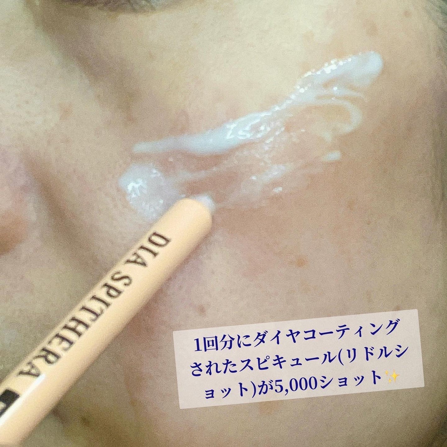 miyukihappy on LIPS 「シワ、リフティング効果✨NUDIQUEダイヤスピテラアンプル@..」(4枚目)