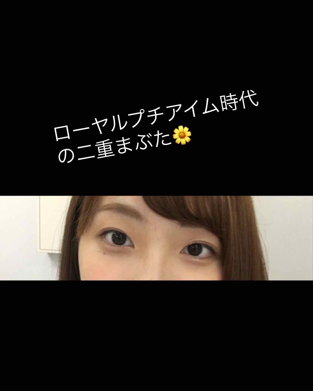 ナイトアイボーテ/StreeTrend/二重まぶた用アイテムを使ったクチコミ(3枚目)