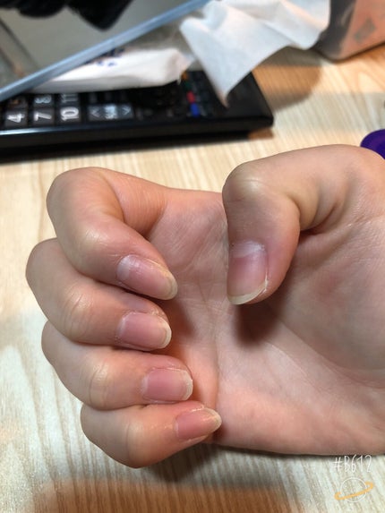 ウィンマックス ネイルハードナー/DAISO/ネイルオイル・トリートメントを使ったクチコミ(2枚目)