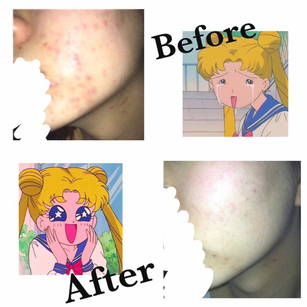 化粧水・敏感肌用・高保湿タイプ/無印良品/化粧水を使ったクチコミ(2枚目)