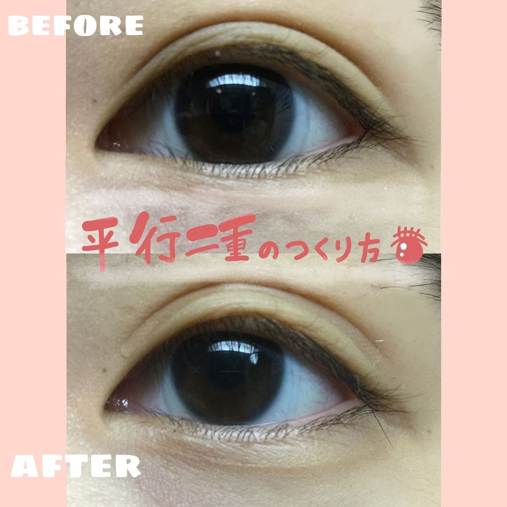 のびーるアイテープ(絆創膏タイプ、レギュラー)/DAISO/二重まぶた用アイテムを使ったクチコミ(1枚目)