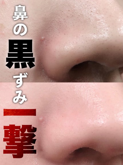 シルコット うるうるコットン/シルコット/コットンを使ったクチコミ(1枚目)