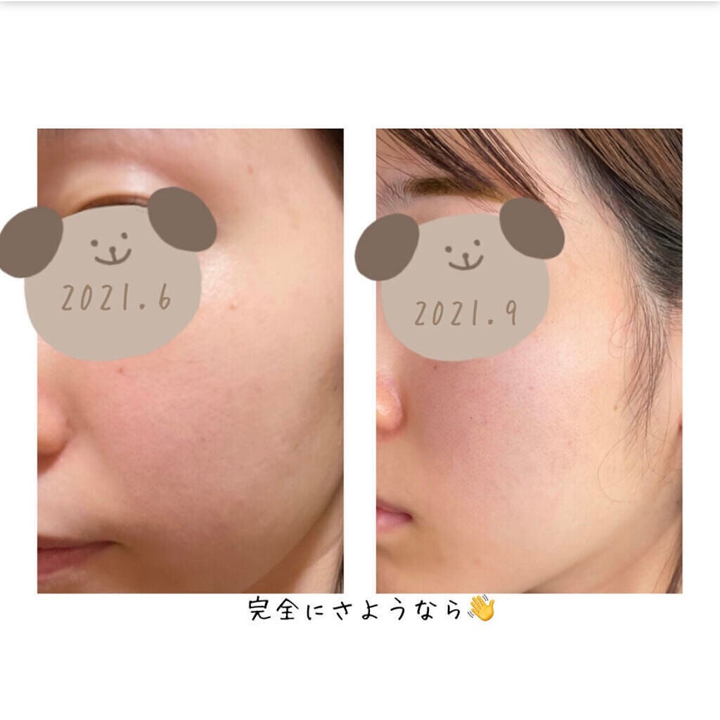 ザ・タイムR アクア/IPSA/化粧水を使ったクチコミ(8枚目)