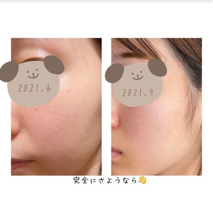 ザ・タイムR アクア/IPSA/化粧水を使ったクチコミ(8枚目)