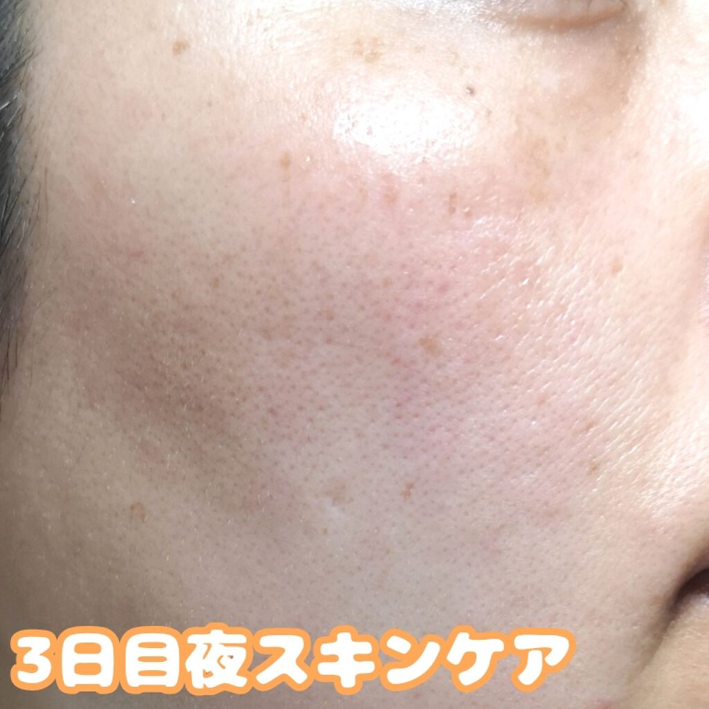 アレルバリア エッセンス BB/d プログラム/BBクリームを使ったクチコミ(4枚目)