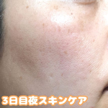 アレルバリア エッセンス BB/d プログラム/BBクリームを使ったクチコミ(4枚目)