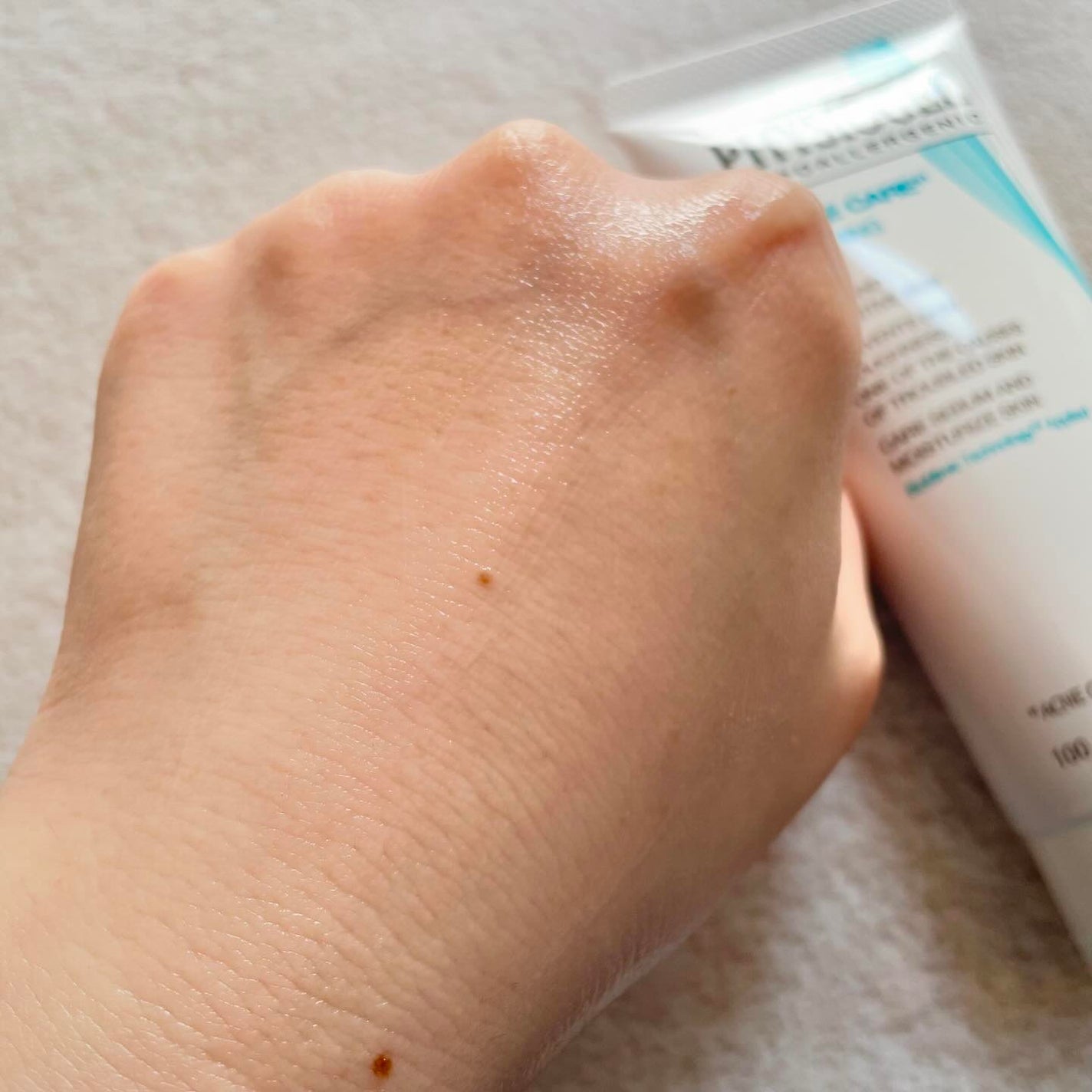 アクネケア クリアリング フェイシャル ゲル/PHYSIOGEL/フェイスクリームを使ったクチコミ(3枚目)