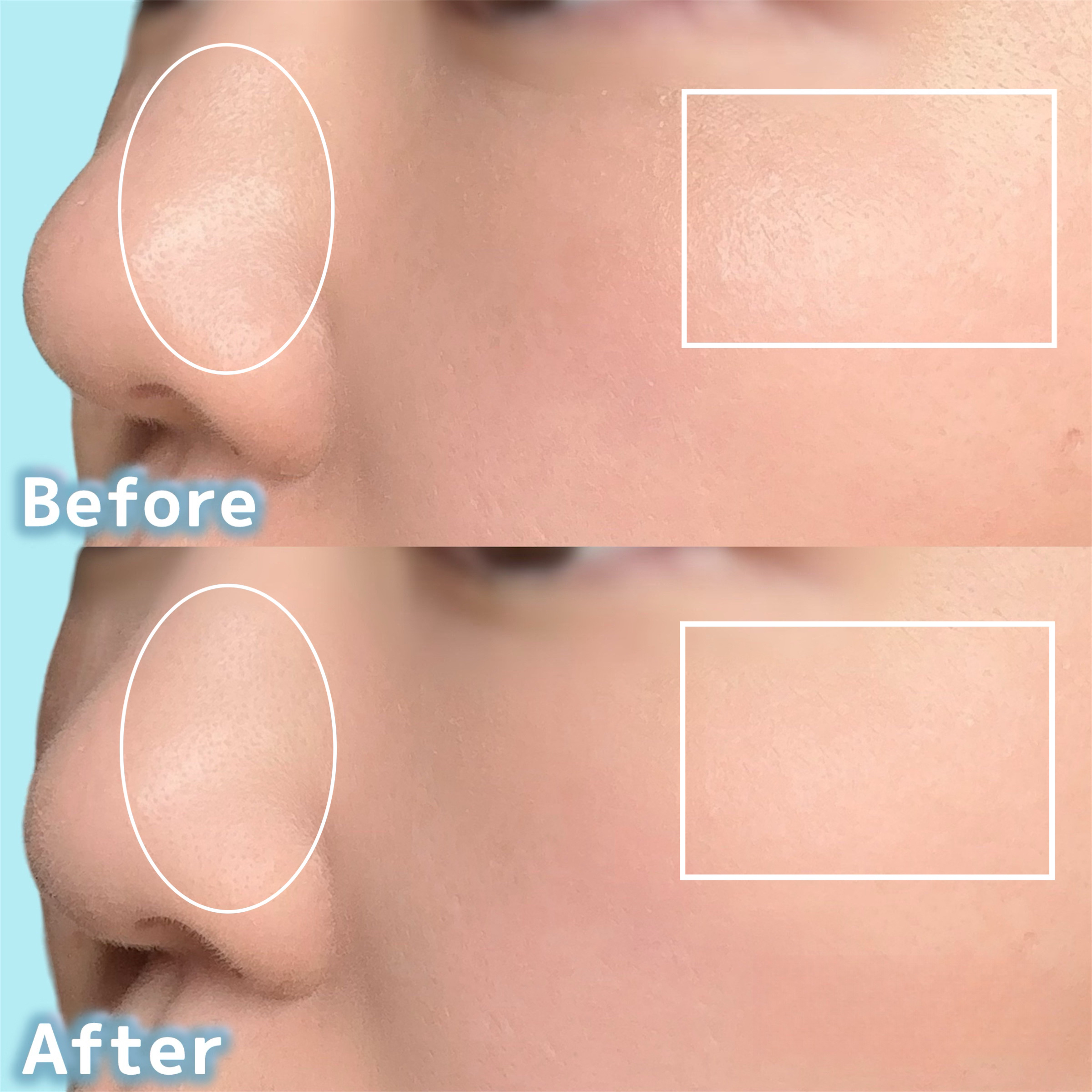 エテュセ ポアレスプライマー クール/ettusais/化粧下地を使ったクチコミ（3枚目）