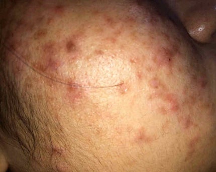 ハトムギ化粧水(ナチュリエ スキンコンディショナー R )/ナチュリエ/化粧水を使ったクチコミ(2枚目)