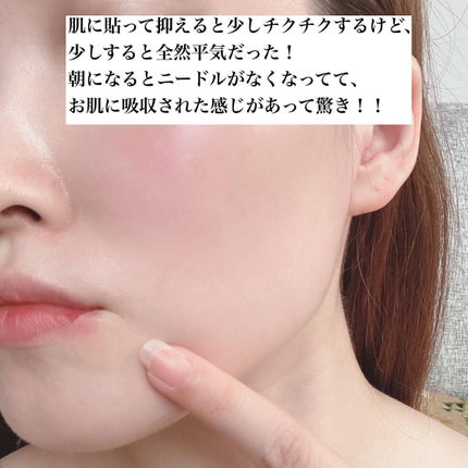 ディープビタCパッチ/MEDICUBE/その他スキンケアを使ったクチコミ(3枚目)