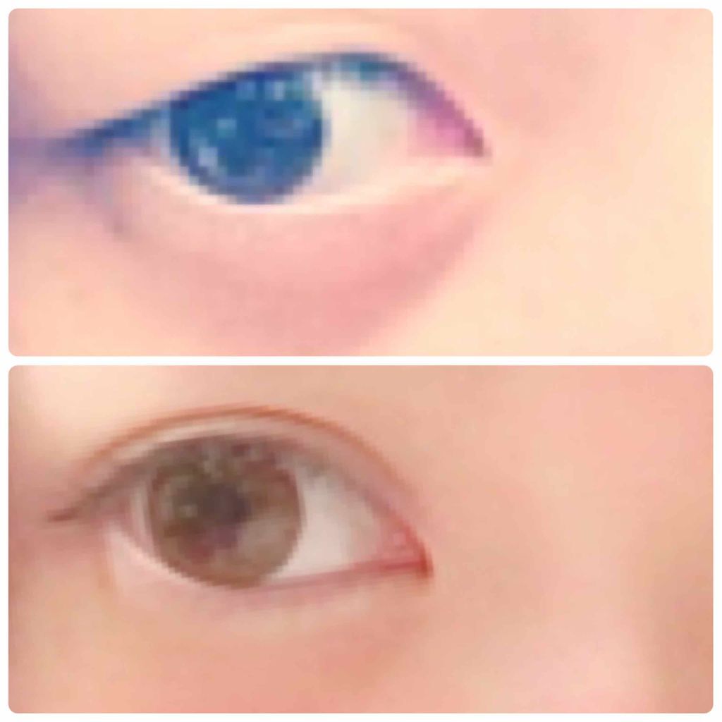 ワンダーアイリッドテープ Extra/D-UP/二重まぶた用アイテムを使ったクチコミ（1枚目）