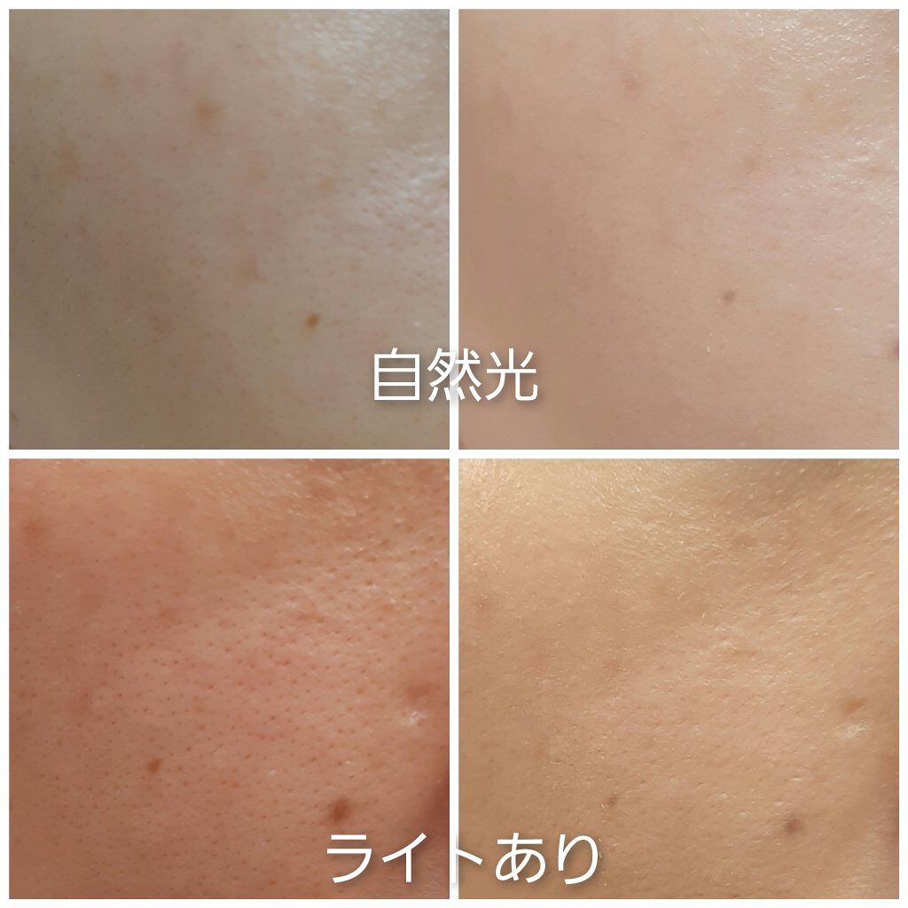 ドクタージャルト シカペア リカバー (第2世代）/Dr.Jart＋/フェイスクリームを使ったクチコミ（1枚目）