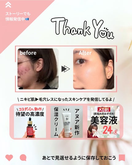 なぎ | スキンケア薬剤師 on LIPS 「◀︎ニキビ肌から毛穴レスになった薬剤師みんなメガ割何買った?🛍..」(9枚目)