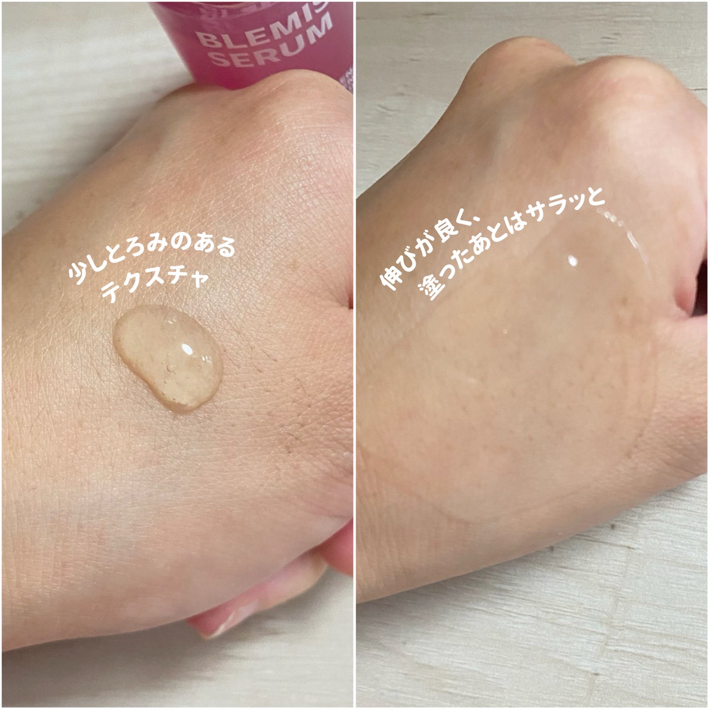 ブレミッシュケアアップ セラム/ISOI/美容液を使ったクチコミ(2枚目)