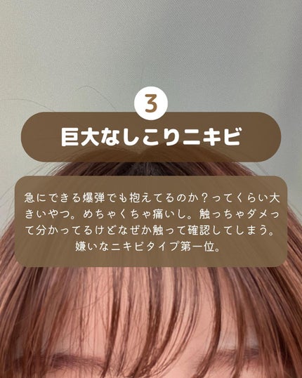 ガラクナイアシン2.0エッセンス/manyo/美容液を使ったクチコミ(4枚目)