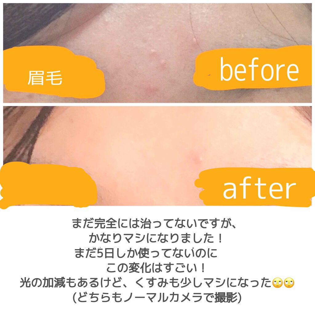 エクストラ スターダスト ジェル/シュープリームノイ/オールインワン化粧品を使ったクチコミ(3枚目)