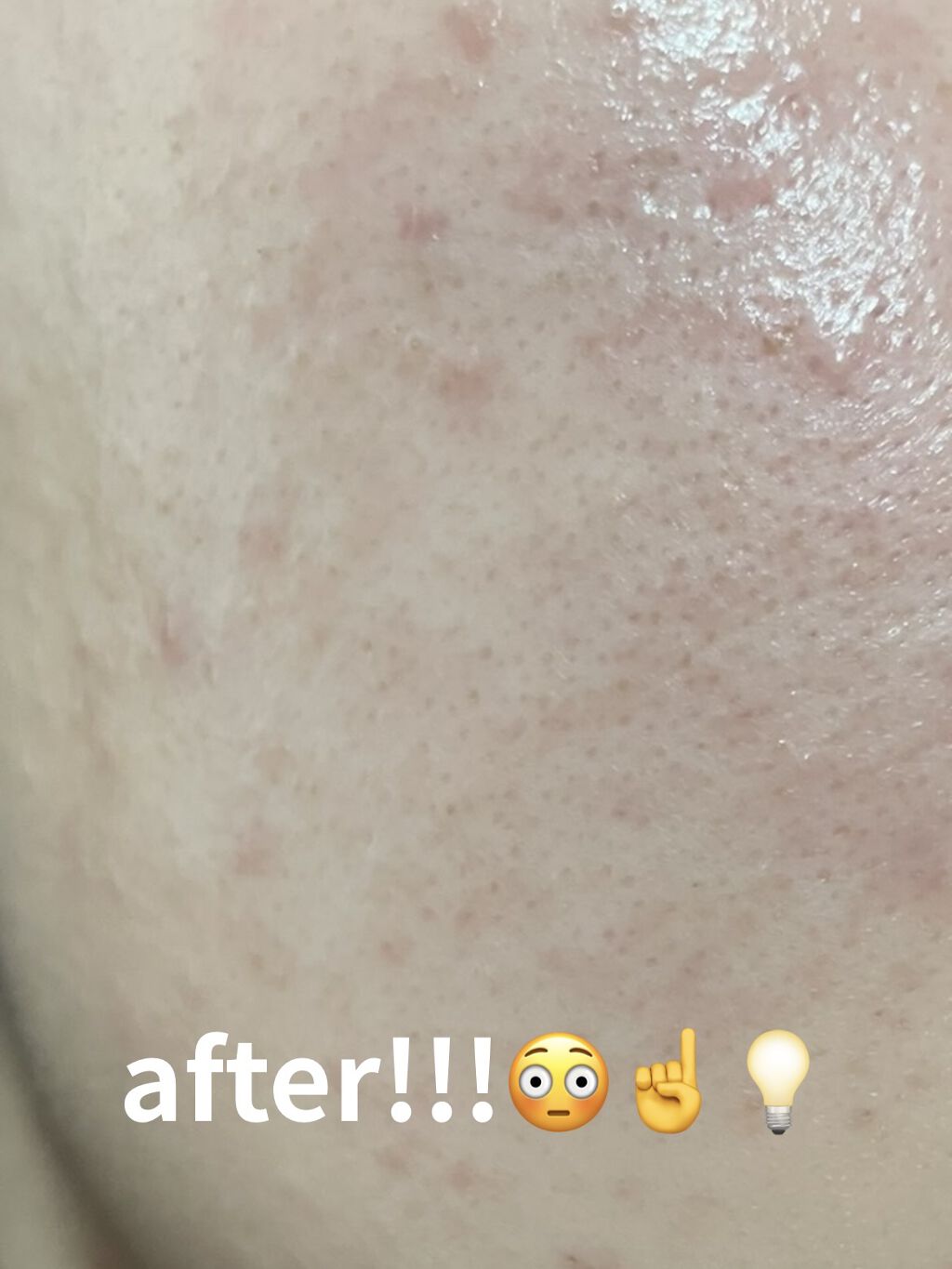 ティーツリーケアソリューション アンプルマスクJEX/MEDIHEAL/シートマスク・パックを使ったクチコミ（2枚目）