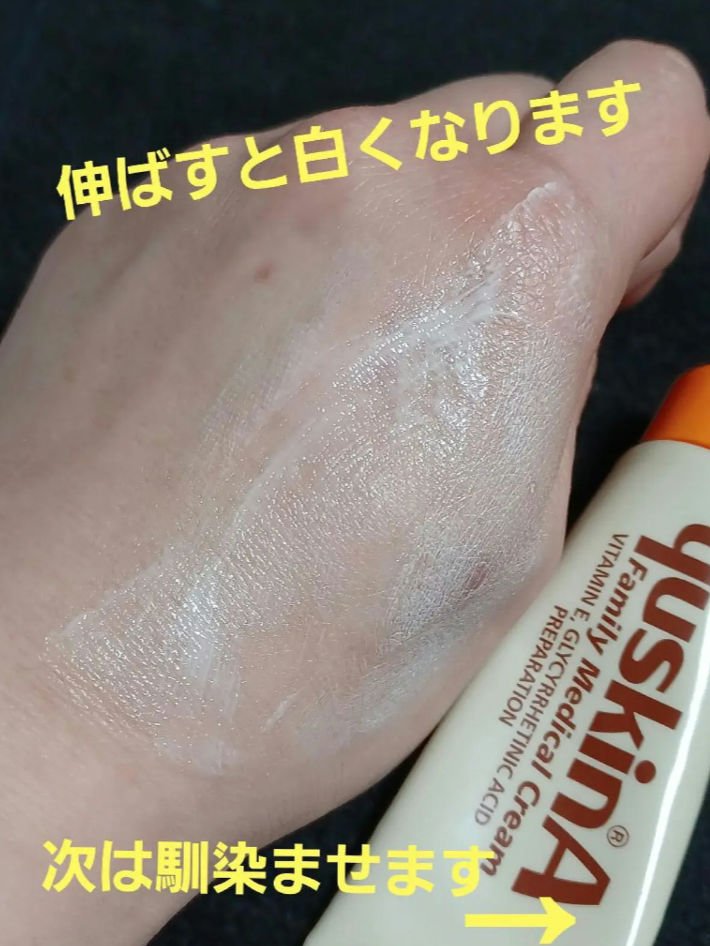 ユースキン 30gチューブ/ユースキン/ボディクリームを使ったクチコミ（3枚目）