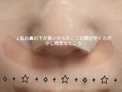 LUNA on LIPS 「ルルルンHYDRA-EX-MASKエクソソーム×白玉グルタチオ..」(5枚目)