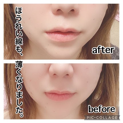 V コントア セラム/CLARINS/美容液を使ったクチコミ(4枚目)