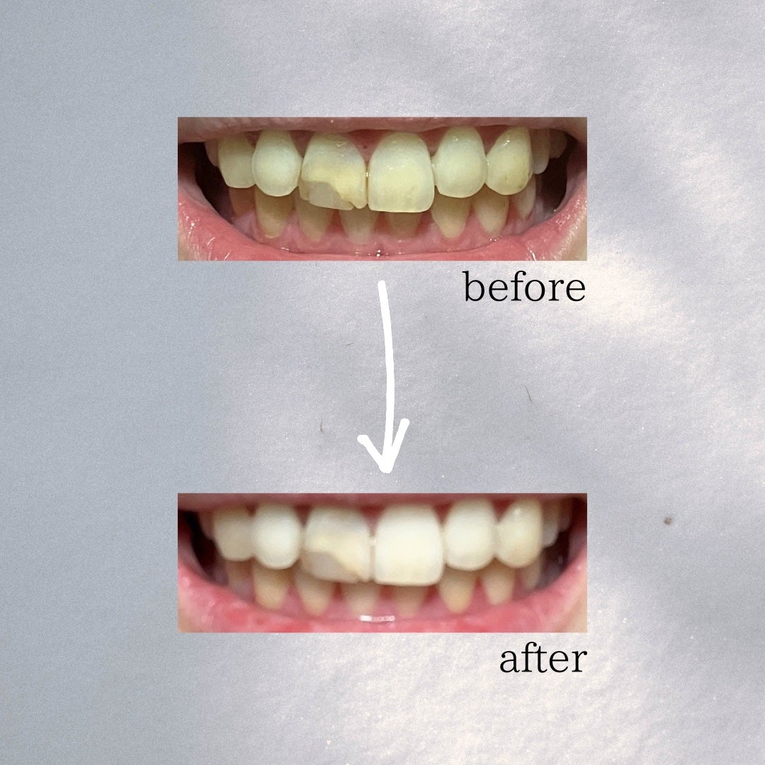 DENTA ONE/シーヴァ/その他を使ったクチコミ(5枚目)