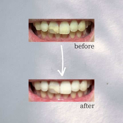 DENTA ONE/シーヴァ/その他を使ったクチコミ(5枚目)