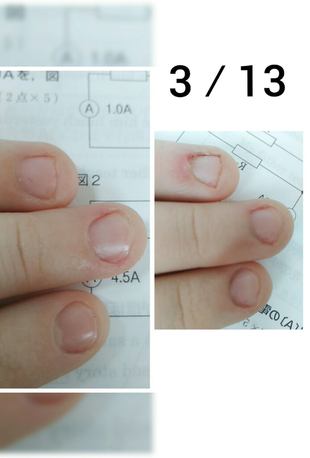 AC キューティクルオイル/AC MAKEUP/ネイルオイル・トリートメントを使ったクチコミ（1枚目）