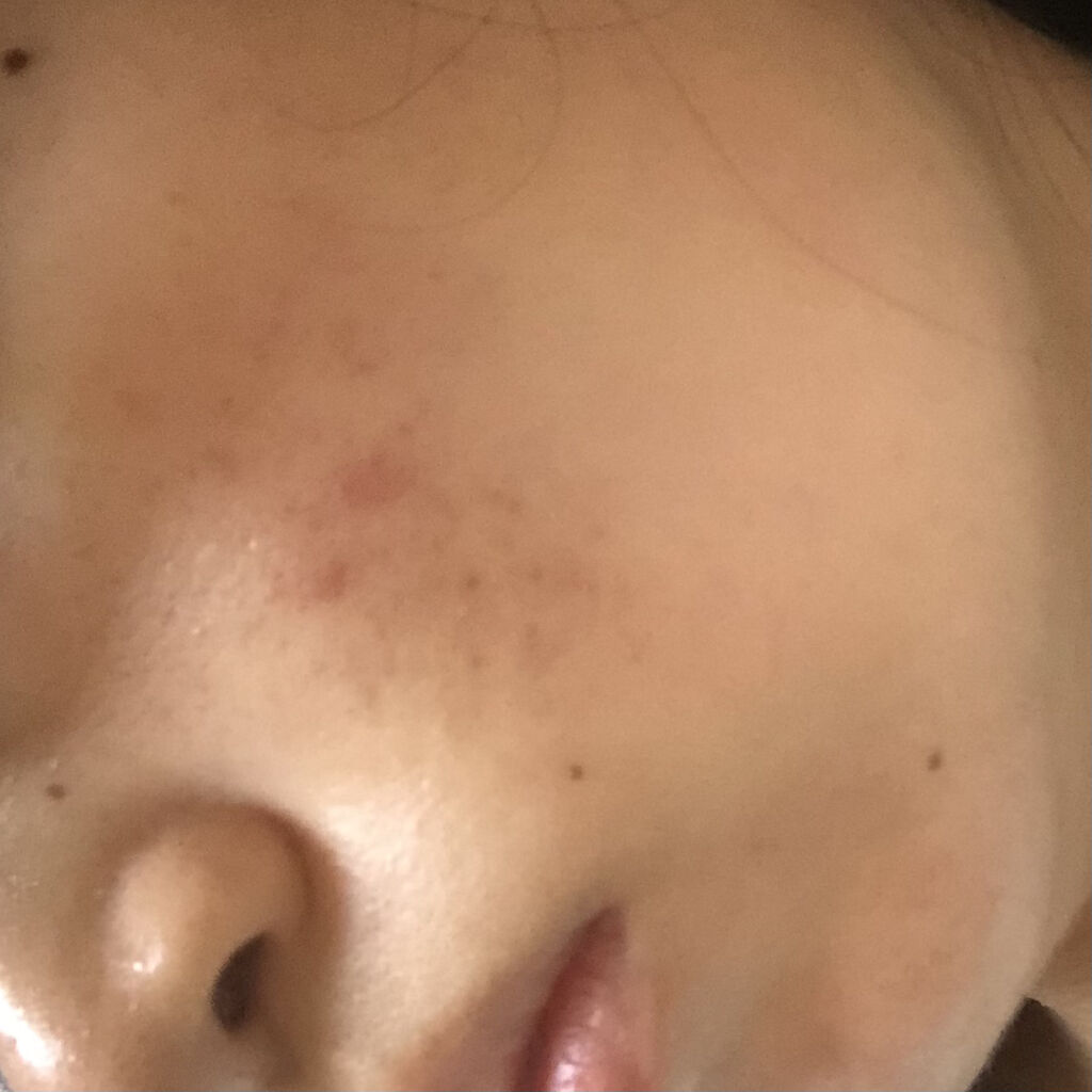 を使ったクチコミ（1枚目）