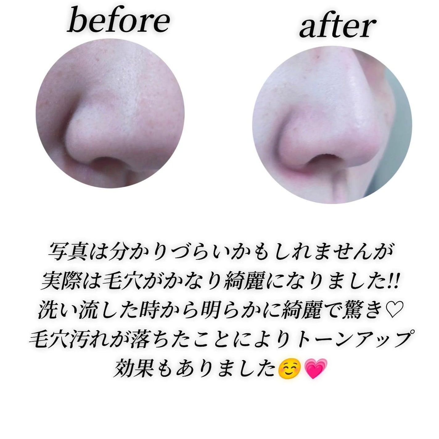 ゼロ毛穴クレイパック/MEDICUBE/洗い流すパック・マスクを使ったクチコミ(5枚目)