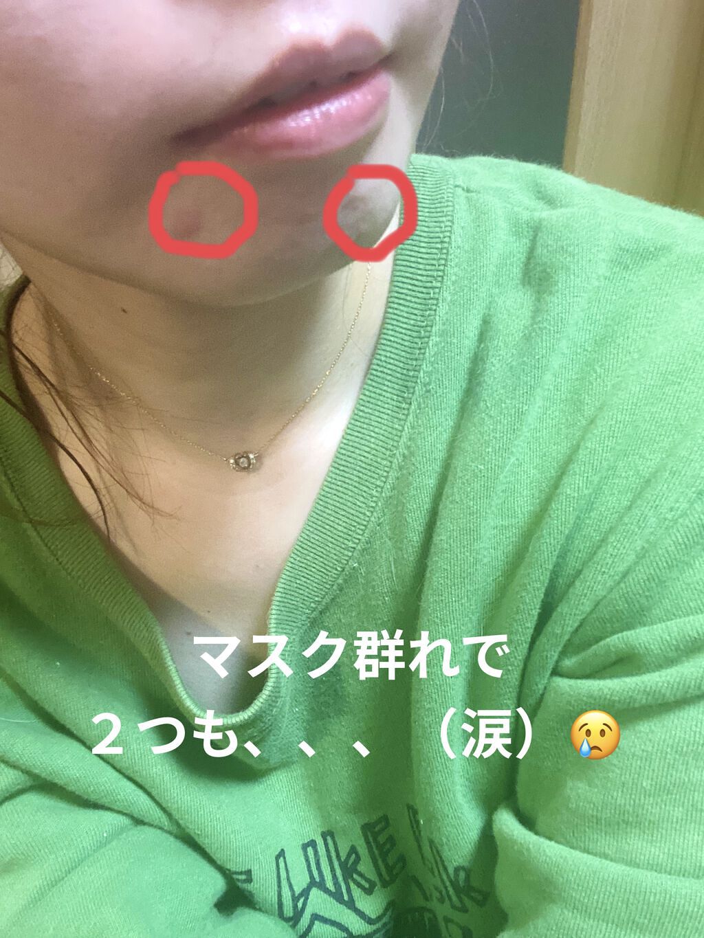 オードムーゲ 薬用ローション（ふきとり化粧水）/オードムーゲ/拭き取り化粧水を使ったクチコミ（2枚目）