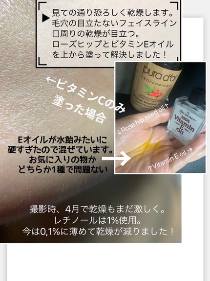 薬用 しみ 集中対策 美容液/メラノCC/美容液を使ったクチコミ(5枚目)