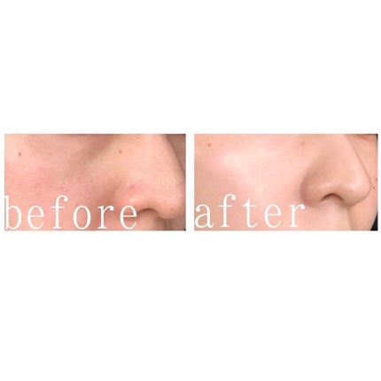 ブラックセラムパクト/celebeau/クリーム・エマルジョンファンデーションを使ったクチコミ(7枚目)