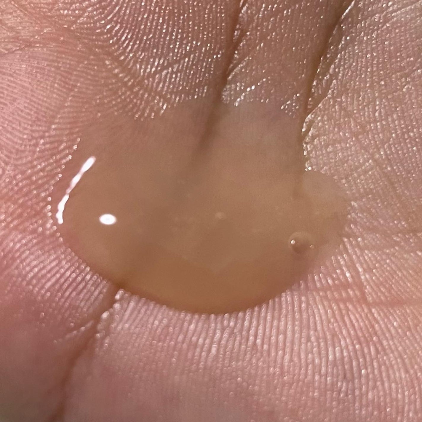 ビフィダバイオーム コンセントレート セラム/manyo/美容液を使ったクチコミ(3枚目)