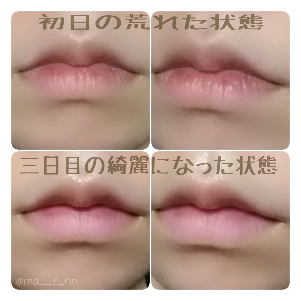 ニベア ディープモイスチャー ナイトプロテクト ニベアの口コミ いいねをくださった皆様 本当にありがとうご By まりりん 敏感肌 Lips