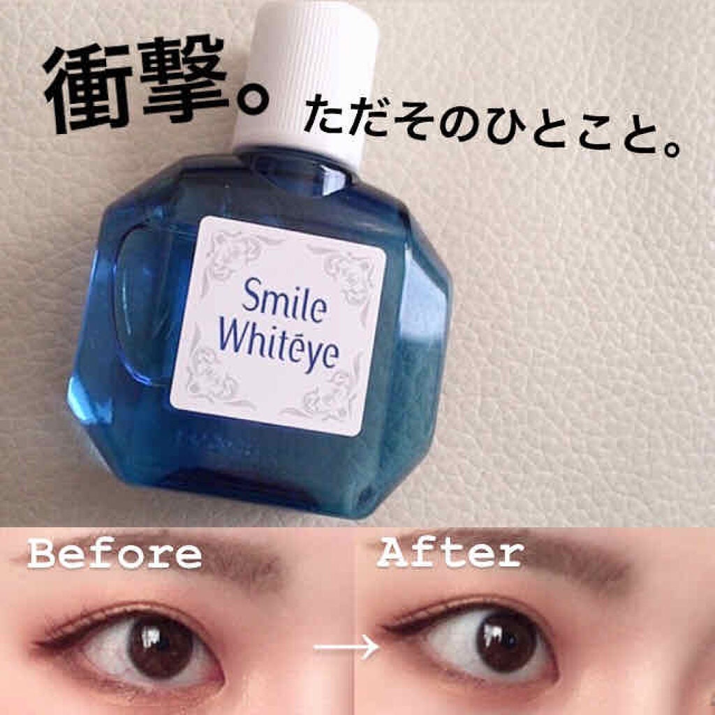 スマイルホワイティエ(医薬品)/ライオン/その他を使ったクチコミ(1枚目)