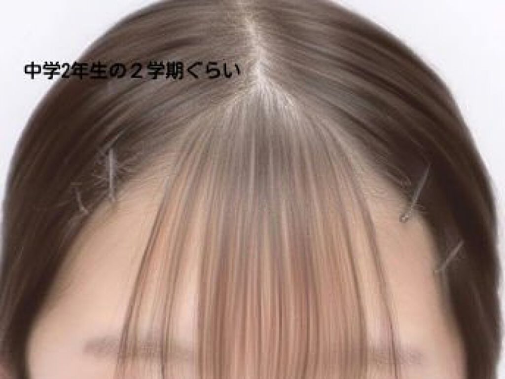 垢抜けたい女の子👧 on LIPS 「これが私の前髪の過去!!みんなこれみて元気出せ!!!!!私の現..」(8枚目)