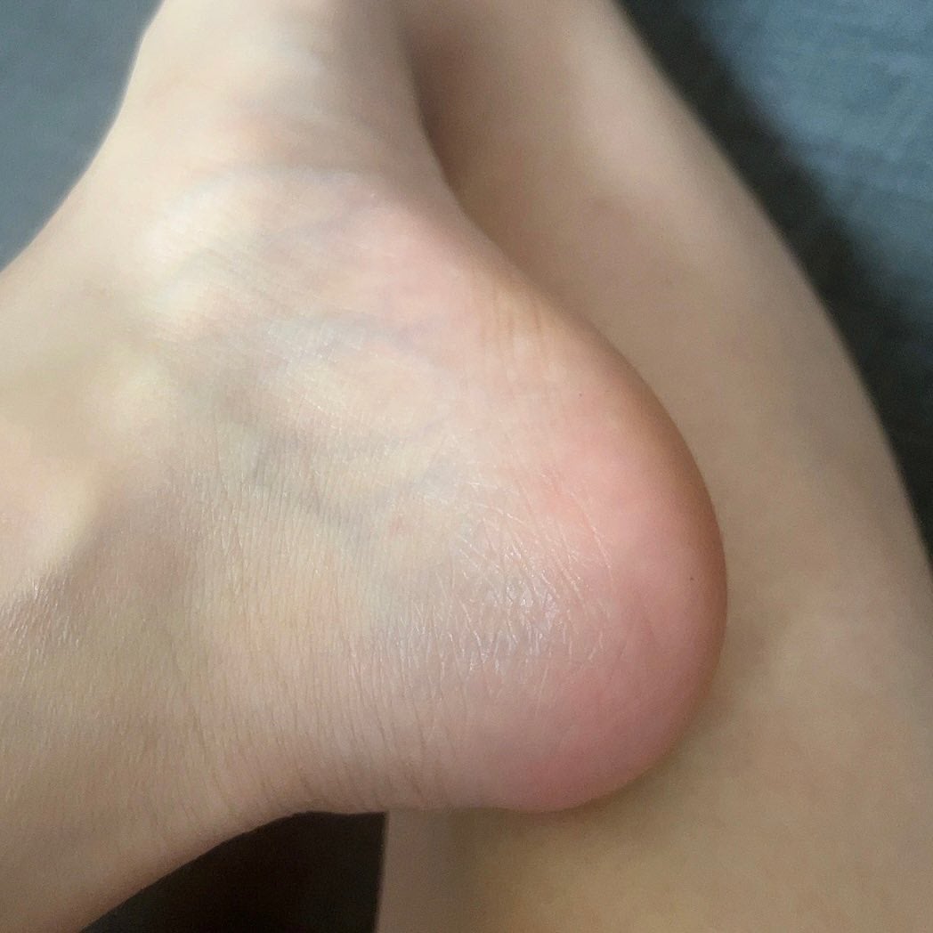 ズボラ主婦。 on LIPS 「いきなり足でごめんなさい👣🙇♀️もうすぐ国際女性デーなのでペ..」(3枚目)