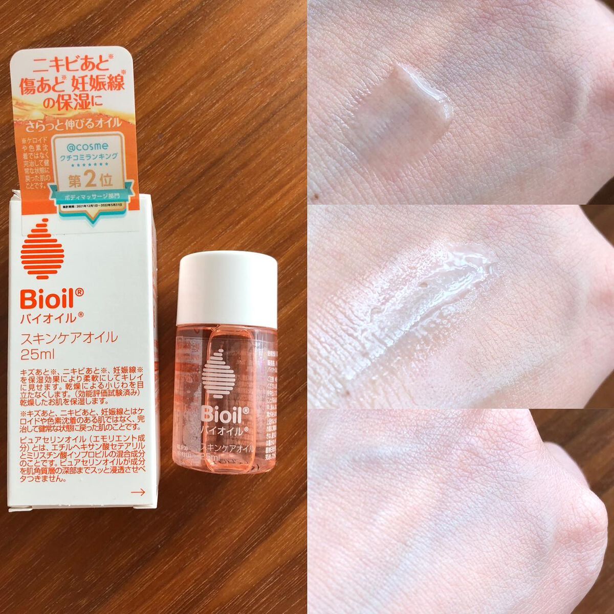 バイオイル/バイオイル/フェイスオイルを使ったクチコミ（2枚目）