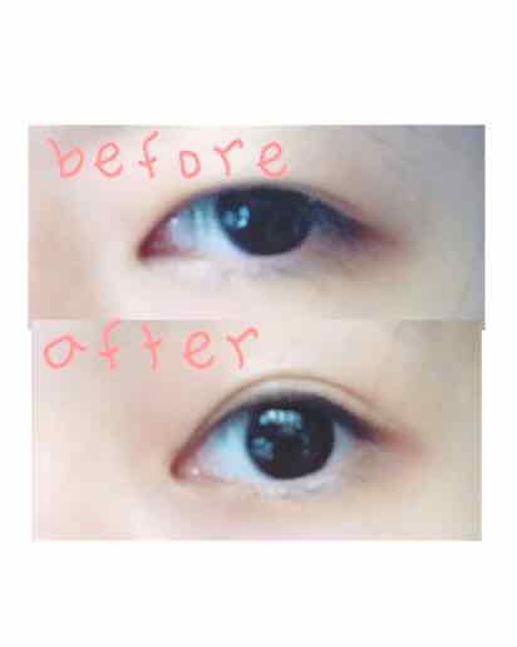 ハイブリッドフィルム/アイトーク/二重まぶた用アイテムを使ったクチコミ(4枚目)