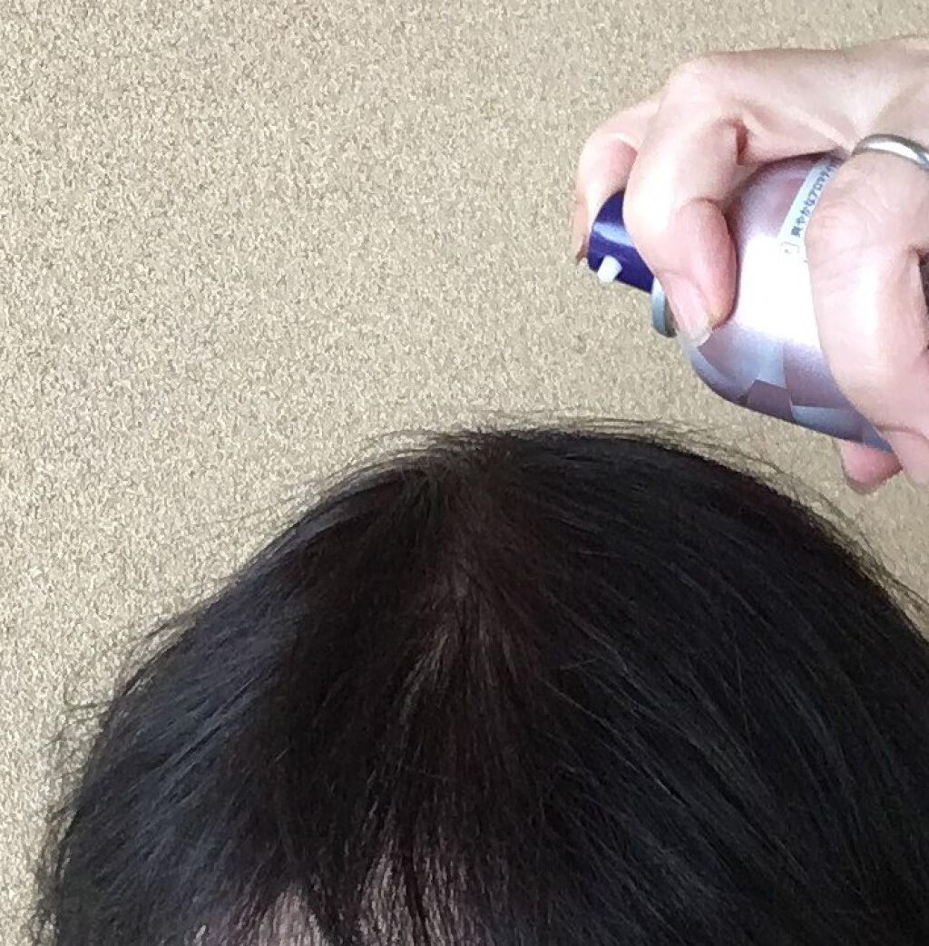 育毛スプレー ボリュームケア/セグレタ/頭皮ローションを使ったクチコミ（3枚目）