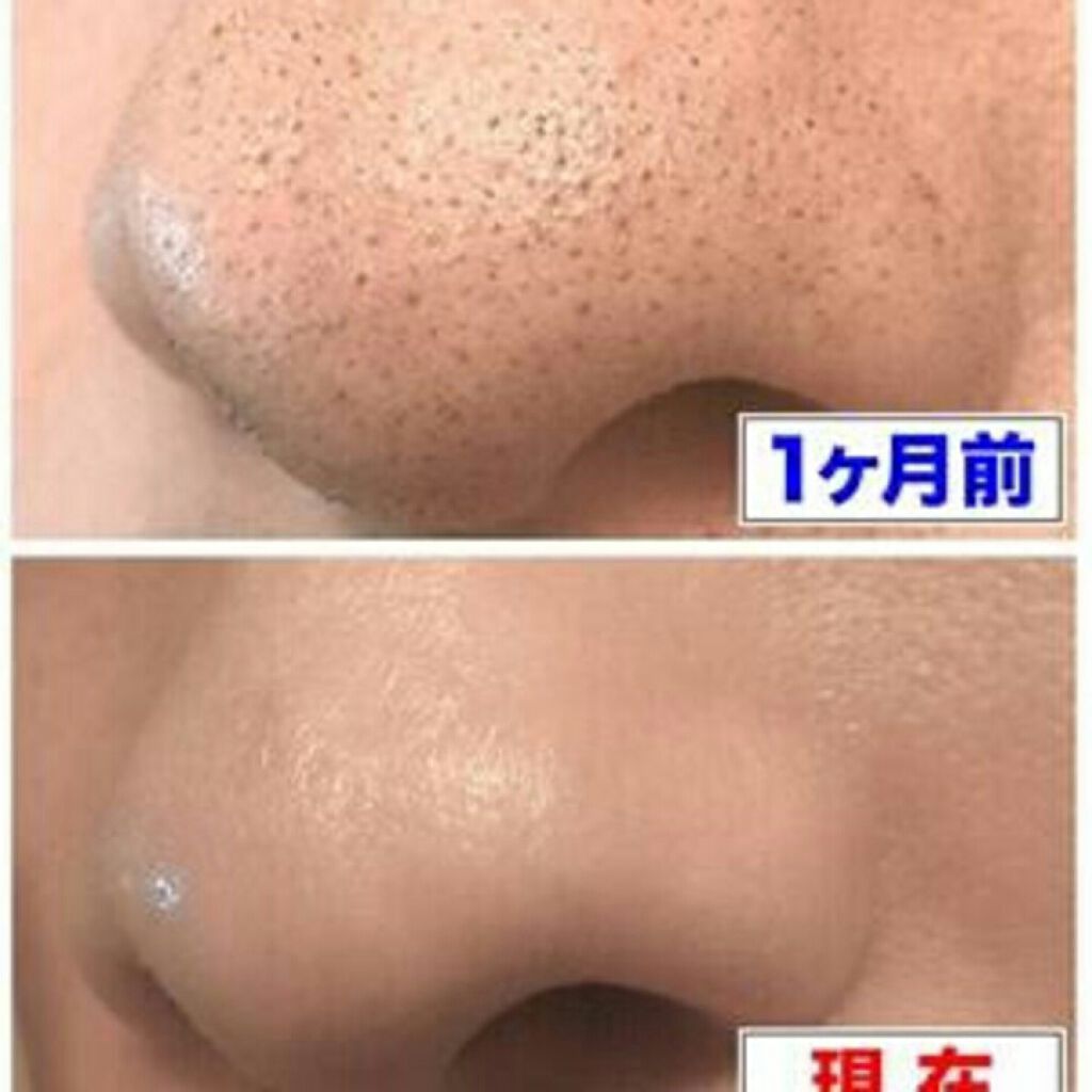 ニベアクリーム/ニベア/ボディクリームを使ったクチコミ(1枚目)