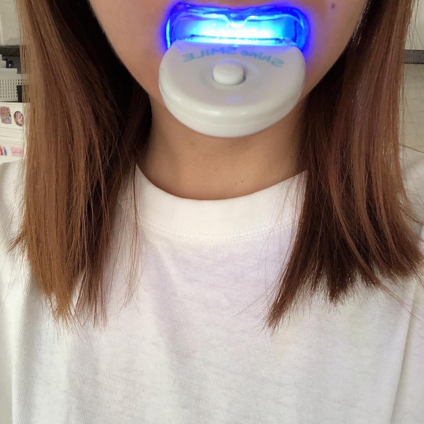 ホワイトニングスタートキット/SHINE SMILE/その他オーラルケアを使ったクチコミ(6枚目)