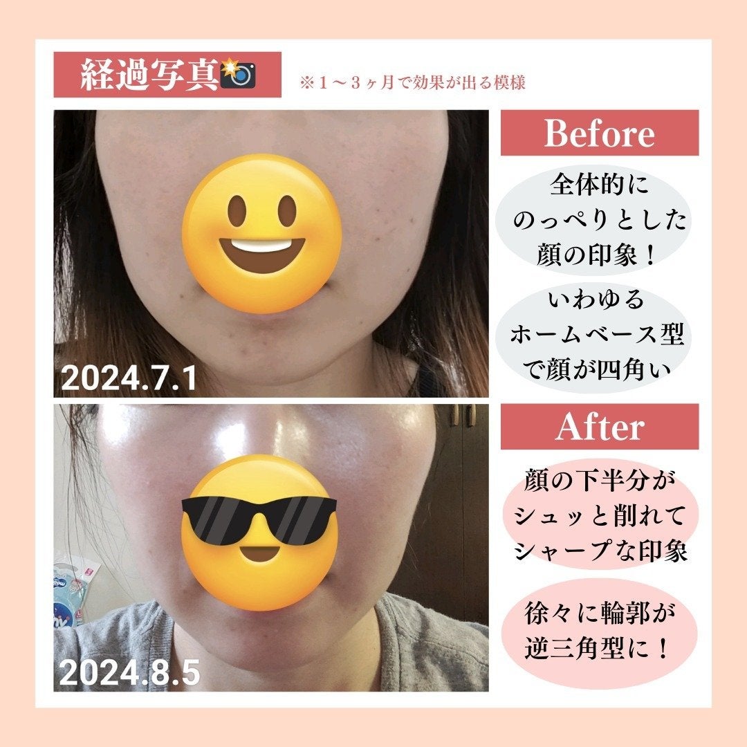 ãããð°ðãã©ãã匷å on LIPS ãç£åŸã®çŸå®¹å»çã«ã€ããŠã·ã§ã¢ããŸãâïžâ¡â¡åºç£ã§10kgå¢ããŠ..ãïŒ5æç®ïŒ