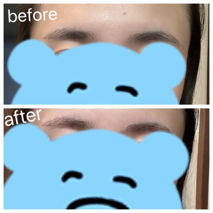 脱色クリーム 敏感肌用/エピラット/ムダ毛ケアを使ったクチコミ(5枚目)