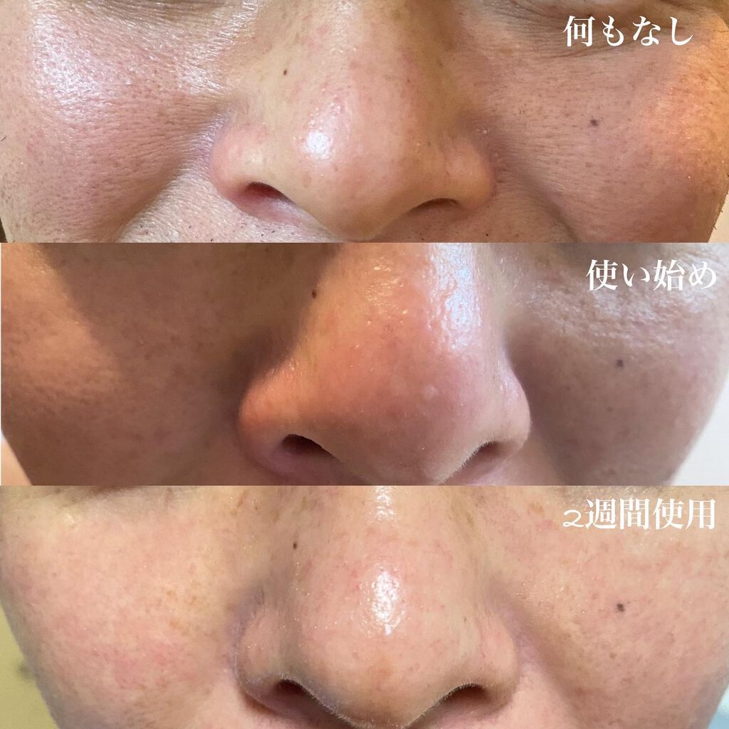 エマルジョンリムーバー 300ml/200ml/水橋保寿堂製薬/その他洗顔料を使ったクチコミ(3枚目)