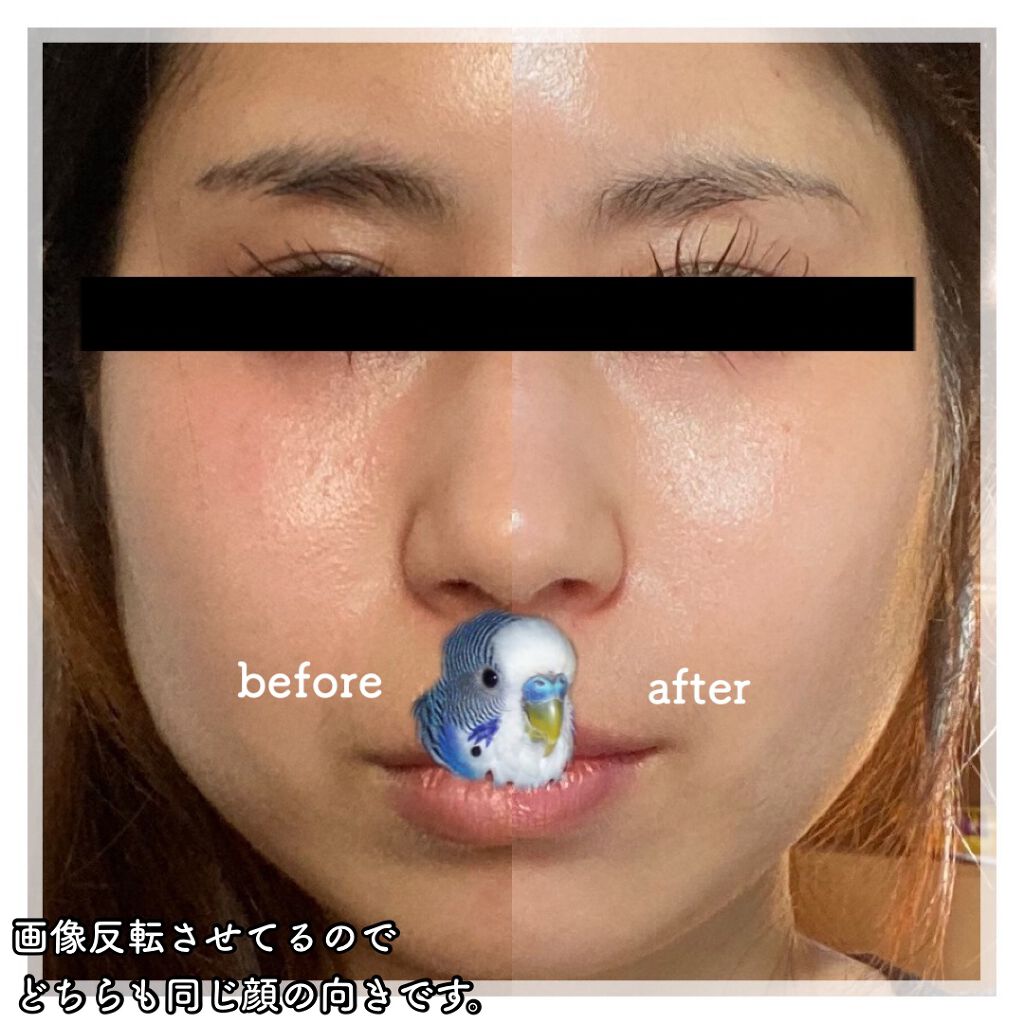 ぴぴ on LIPS 「ダーマローラーレポ!!!!!遅くなってしまってごめんなさい..」(4枚目)