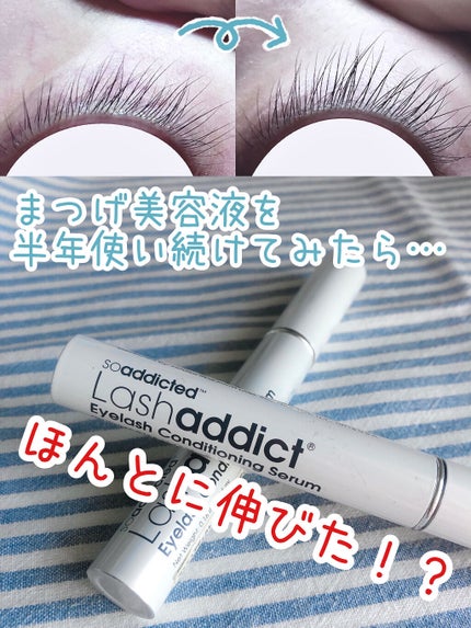 ラッシュアディクト アイラッシュコンディショニングセラム/soaddicted/まつげ美容液を使ったクチコミ(1枚目)