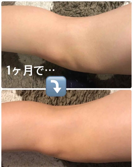 を使ったクチコミ(2枚目)