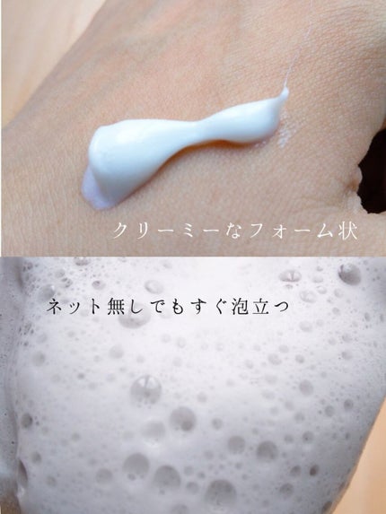 パーフェクトホイップ アクネケア/SENKA(専科)/洗顔フォームを使ったクチコミ(2枚目)